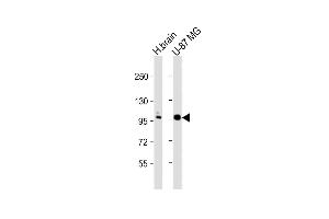 All lanes : Anti-ANO5 Antibody (C-term) at 1:1000 dilution Lane 1: human brain lysate Lane 2: U-87 MG whole cell lysate Lysates/proteins at 20 μg per lane. (Anoctamin 5 抗体  (C-Term))
