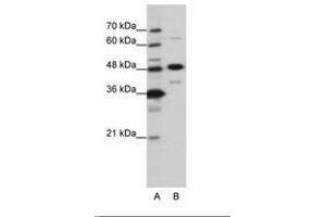 Image no. 2 for anti-Nucleolar Protein 4 (NOL4) (AA 239-288) antibody (ABIN6736202) (NOL4 抗体  (AA 239-288))