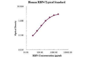 ELISA image for Retinol Binding Protein 4, Plasma (RBP4) ELISA Kit (ABIN3198609) (RBP4 ELISA 试剂盒)