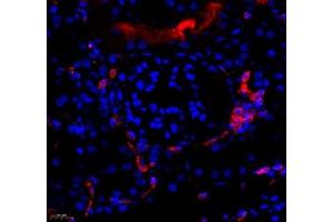 Immunofluorescence (Paraffin-embedded Sections) (IF (p)) image for anti-Mitochondrially Encoded NADH Dehydrogenase 5 (MT-ND5) antibody (ABIN7074659)