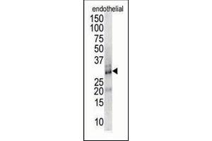 Antibody is used in Western blot to detect DSCR1 in endothelial cell lysate. (RCAN1 抗体  (AA 75-104))