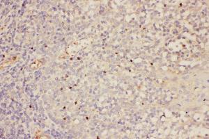 Anti-FOXP3 Picoband antibody,  IHC(P): Human Tonsil Tissue (FOXP3 抗体  (AA 101-431))