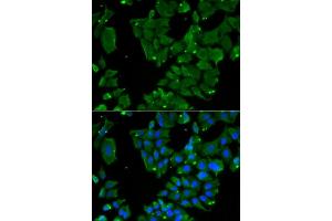 Immunofluorescence analysis of HeLa cells using DBN1 antibody (ABIN6129572, ABIN6139424, ABIN6139425 and ABIN6221983). (DBN1 抗体  (AA 350-649))