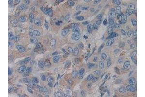 Immunohistochemistry (IHC) image for anti-Cytochrome P450, Family 21, Subfamily A, Polypeptide 2 (CYP21A2) (AA 106-389) antibody (ABIN7441886)