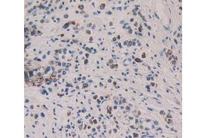 IHC-P analysis of stomach tissue, with DAB staining. (KIR2DL2 抗体  (AA 22-348))