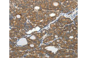 Immunohistochemistry of Human brain using SLC12A4 Polyclonal Antibody at dilution of 1:30 (SLC12A4 抗体)
