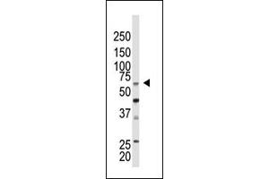 Western Blotting (WB) image for anti-Chromobox Homolog 4 (CBX4) (N-Term) antibody (ABIN357750) (CBX4 抗体  (N-Term))