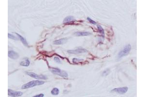 Image no. 1 for anti-PDGF-BB Homodimer antibody (ABIN465590) (PDGF-BB Homodimer 抗体)