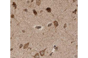 ABIN6277923 at 1/50 staining human brain tissue sections by IHC-P. (PINK1 抗体)