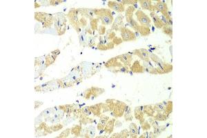 Immunohistochemistry of paraffin-embedded mouse heart using TBXAS1 antibody (ABIN6293260) at dilution of 1:100 (40x lens). (TBXAS1 抗体)