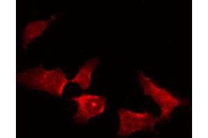 ABIN6274078 staining HepG2 by IF/ICC. (TNK2 抗体  (pTyr857, pTyr858))