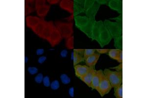 ABIN6265968 and ABIN6277114 staining Hela cells(24h of starvation treatment) by IF/ICC.