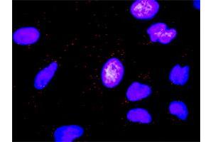 Proximity Ligation Analysis of protein-protein interactions between MMP7 and FASLG. (FASL 抗体  (AA 1-281))