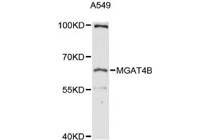Western blot analysis of extracts of A-549 cells, using MGAT4B antibody (ABIN6292737) at 1:3000 dilution. (MGAT4B 抗体)