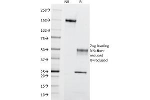 SDS-PAGE Analysis of Purified CD195 Mouse Monoclonal Antibody (12D1). (CCR5 抗体)