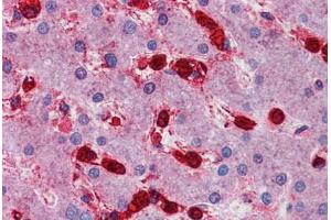 Human Liver: Formalin-Fixed, Paraffin-Embedded (FFPE) (MAP4K4 抗体  (AA 287-336))