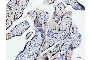 IHC analysis of C1orf77/FOP/CHTOP using anti-C1orf77/FOP/CHTOP antibody (ABIN7603201). (CHTOP 抗体  (N-Term))