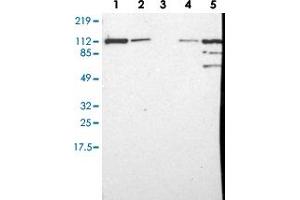 Western blot analysis of Lane 1: RT-4, Lane 2: U-251 MG, Lane 3: Human Plasma, Lane 4: Liver, Lane 5: Tonsil with MVP polyclonal antibody (PAB28550) at 1:250-1:500 dilution.