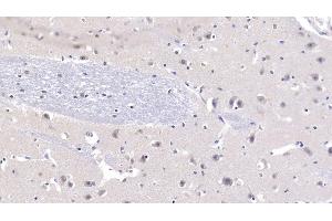 Detection of NT3 in Human Cerebrum Tissue using Polyclonal Antibody to Neurotrophin 3 (NT3) (Neurotrophin 3 抗体  (AA 130-255))