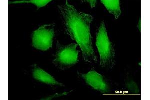 Immunofluorescence (IF) image for anti-Tryptophanyl-tRNA Synthetase (WARS) (AA 50-149) antibody (ABIN521367)