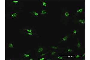 Immunofluorescence of purified MaxPab antibody to ABHD11 on HeLa cell. (ABHD11 抗体  (AA 1-315))