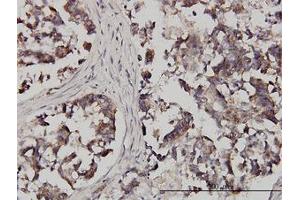 Image no. 1 for anti-Fragile X Mental Retardation, Autosomal Homolog 1 (FXR1) (AA 121-220) antibody (ABIN599029) (FXR1 抗体  (AA 121-220))