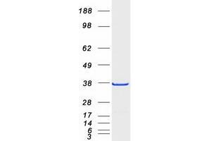 Western Blotting (WB) image for Acidic (Leucine-Rich) Nuclear phosphoprotein 32 Family, Member E (ANP32E) (Transcript Variant 1) protein (Myc-DYKDDDDK Tag) (ABIN2714754)