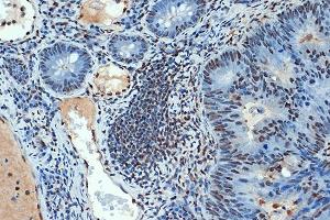 Immunohistochemistry (IHC) image for anti-Small Ubiquitin Related Modifier 4 (SUMO4) antibody (ABIN7270372)