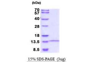 SDS-PAGE (SDS) image for LINGO (AA 241-337) protein (His tag) (ABIN5854137) (LINGO (AA 241-337) protein (His tag))
