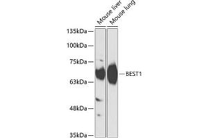 Western blot analysis of extracts of various cell lines, using BEST1 antibody (ABIN6127515, ABIN6137534, ABIN6137536 and ABIN6218300) at 1:1000 dilution. (Bestrophin 1 抗体  (AA 376-585))