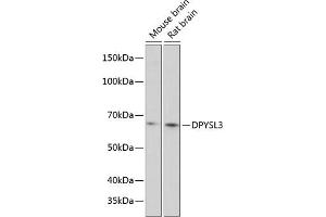 Western blot analysis of extracts of various cell lines, using DPYSL3 Polyclonal Antibody (ABIN6130137, ABIN6139811, ABIN6139812 and ABIN6215891) at 1:1000 dilution. (DPYSL3 抗体  (AA 1-280))