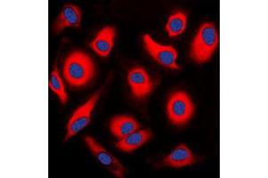 Immunofluorescent analysis of APOA1BP staining in HEK293T cells. (APOA1BP 抗体  (Center))