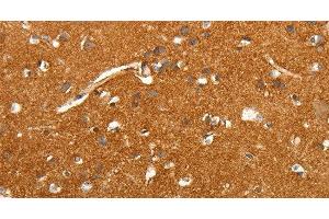 Immunohistochemistry of paraffin-embedded Human brain tissue using SLC4A4 Polyclonal Antibody at dilution 1:50 (SLC4A4 抗体)