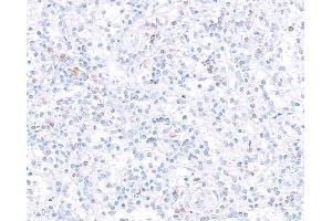 Immunohistochemistry (IHC) image for anti-Interleukin 7 Receptor (IL7R) (AA 21-236) antibody (ABIN7453897) (Recombinant IL7R 抗体  (AA 21-236))