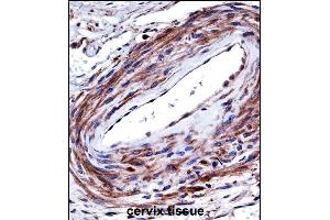 P2RX5 Antibody (C-term) ((ABIN657980 and ABIN2846926))immunohistochemistry analysis in formalin fixed and paraffin embedded human cervix tissue followed by peroxidase conjugation of the secondary antibody and DAB staining. (P2RX5 抗体  (C-Term))