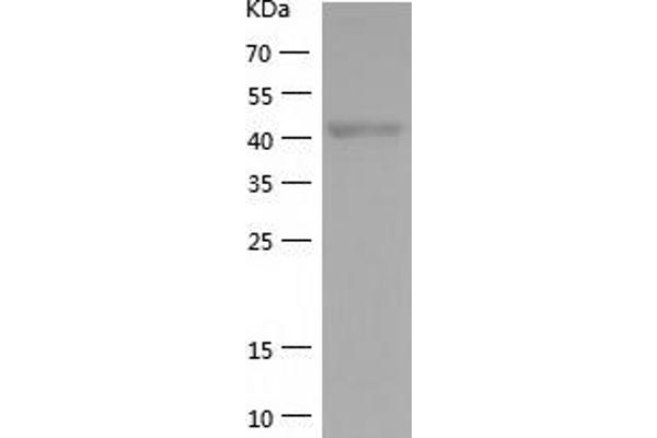 YY1 Protein (AA 1-414) (His tag)