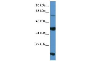 Western Blot showing NTNG2 antibody used at a concentration of 1-2 ug/ml to detect its target protein. (Netrin G2 抗体  (Middle Region))