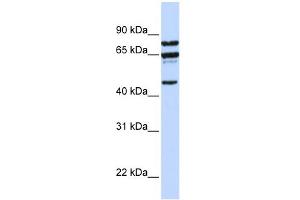 WB Suggested Anti-PPP4R2 Antibody Titration:  0. (PPP4R2 抗体  (C-Term))