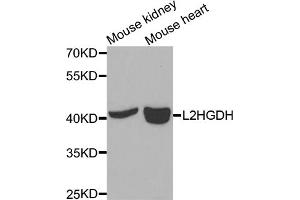 Western blot analysis of extracts of various cell lines, using L2HGDH antibody (ABIN5975242) at 1/1000 dilution. (L2HGDH 抗体)