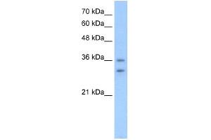 WB Suggested Anti-OR6C70 Antibody Titration:  2. (OR6C70 抗体  (C-Term))