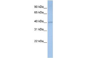 WB Suggested Anti-PDSS1 Antibody Titration:  0. (PDSS1 抗体  (Middle Region))