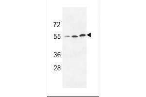 Western blot analysis of anti-URKL1 Pab (ABIN391288 and ABIN2841330) in 293 cell line lysate (35 μg/lane). (UCKL1 抗体  (N-Term))
