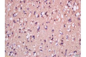 Immunohistochemistry (Paraffin-embedded Sections) (IHC (p)) image for anti-Methionine Sulfoxide Reductase B2 (MSRB2) (AA 31-130) antibody (ABIN2559523)