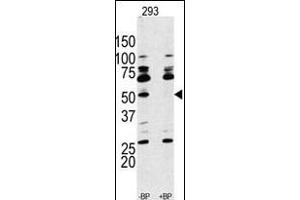 Western blot analysis of anti-RPS6KB1 Antibody (Center) Pab (ABIN389685 and ABIN2839654) pre-incubated with and without blocking peptide (BPNULL) in 293 cell line lysate. (RPS6KB1 抗体  (AA 277-306))