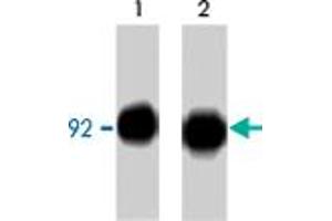 Western blot analysis of CTNNB1 immunoprecipitated from A-431 cells treated with pervanadate. (CTNNB1 抗体  (C-Term))