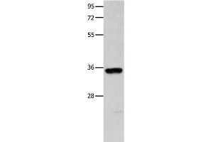Western Blot analysis of Mouse brain tissue using COX11 Polyclonal Antibody at dilution of 1:600 (COX11 抗体)