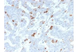 Formalin-fixed, paraffin-embedded human Colon stained with MUC2 Rabbit Recombinant Monoclonal Antibody (MLP/2970R). (Recombinant MUC2 抗体)