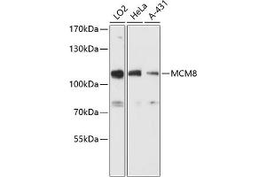 Western blot analysis of extracts of various cell lines, using MCM8 antibody (ABIN6129652, ABIN6143648, ABIN6143649 and ABIN6216734) at 1:3000 dilution. (MCM8 抗体  (AA 591-840))