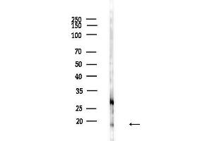 anti-Eukaryotic Translation Initiation Factor 5A (EIF5A) (Internal Region) antibody