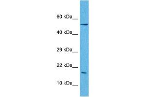 Host:  Rabbit  Target Name:  LEP  Sample Tissue:  Human A549 Whole Cell  Antibody Dilution:  1ug/ml (Leptin 抗体  (N-Term))